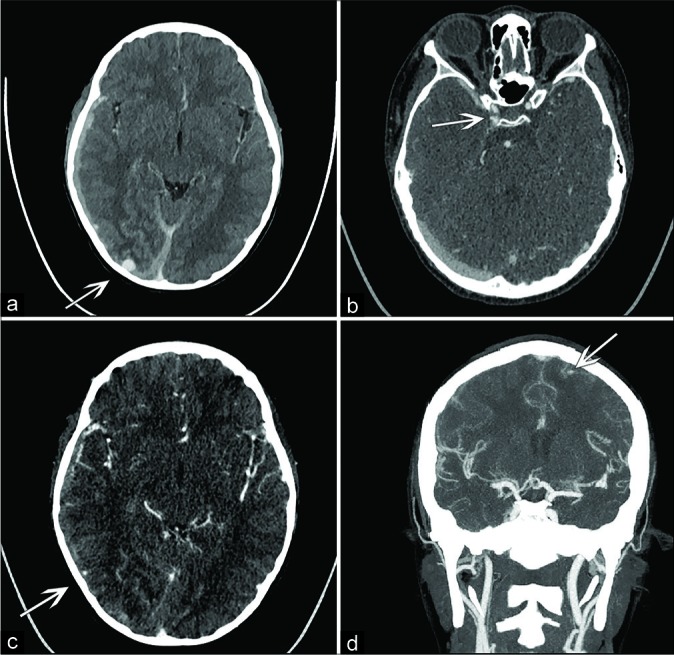 Figure 1: