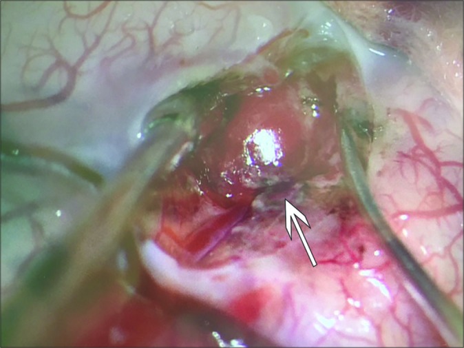 Figure 4: