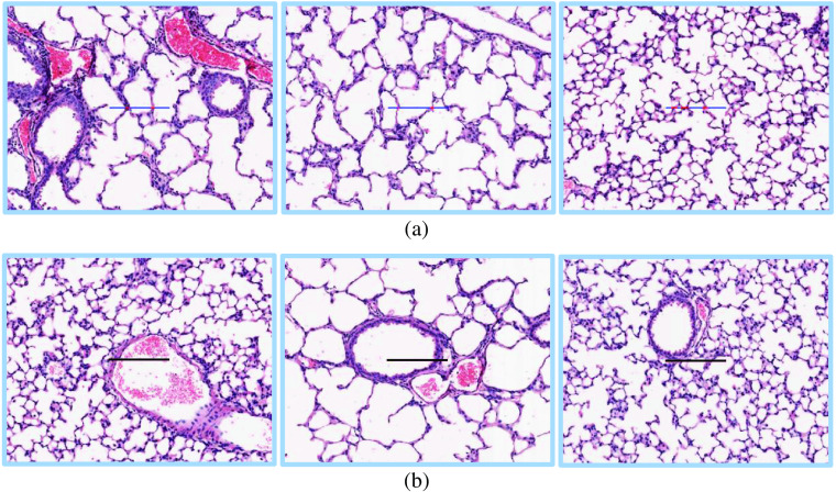 Fig. 11