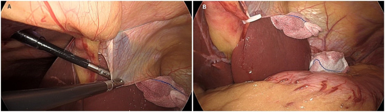 Fig. 5