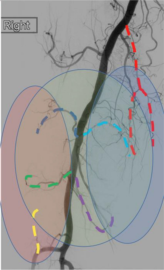 Fig. 1