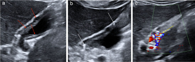 Fig. 12