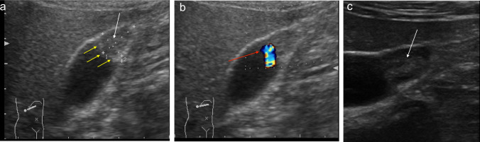 Fig. 10