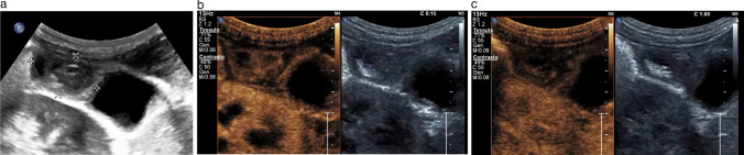 Fig. 14