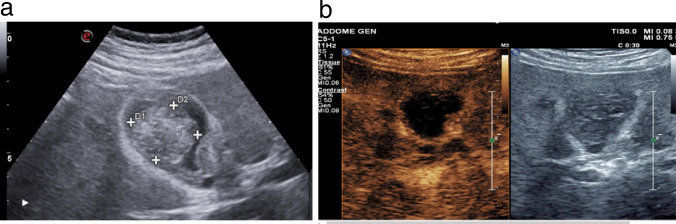 Fig. 15