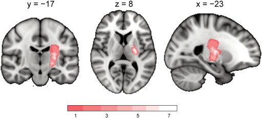 Fig. 1