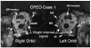 FIG 1