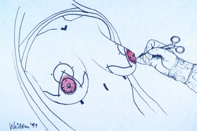 Figure 7B)