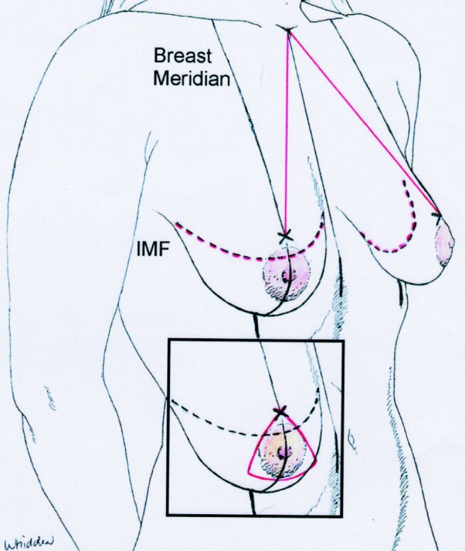 Figure 2)