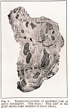 349