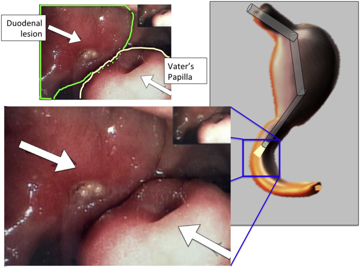 Fig. 2