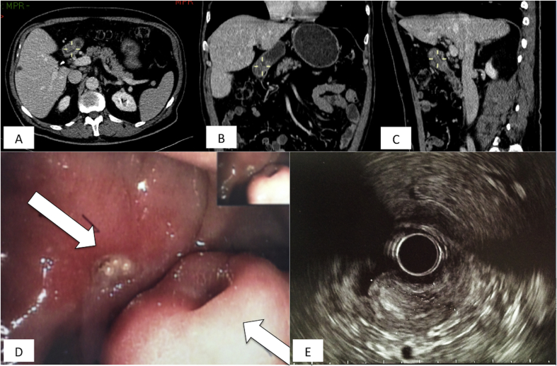 Fig. 1