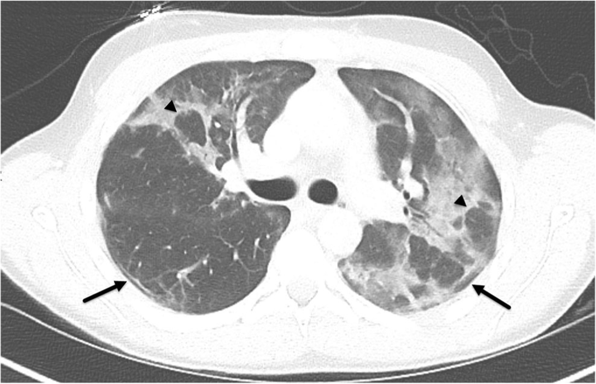 Fig. 2