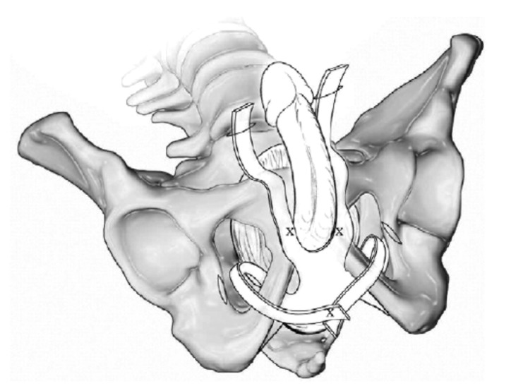 Fig. 11.