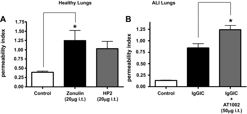 Zonulin as prehaptoglobin2 regulates lung permeability and activates ...