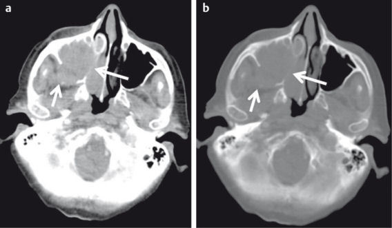 Figure 18