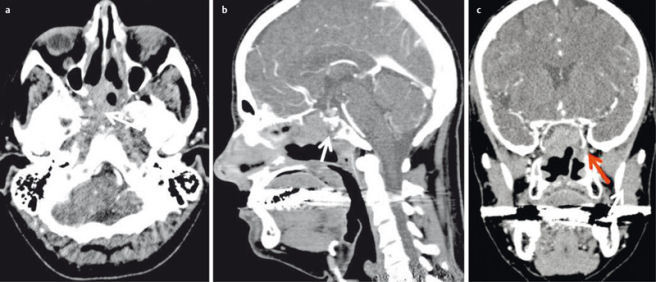 Figure 19