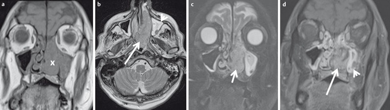 Figure 26