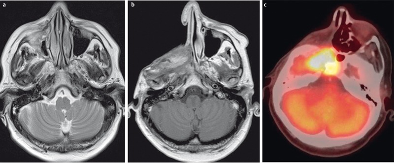 Figure 24