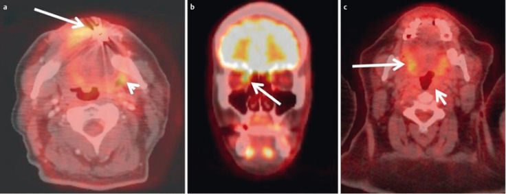 Figure 25