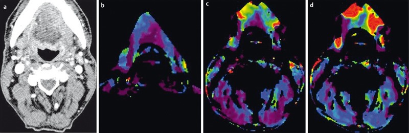 Figure 20