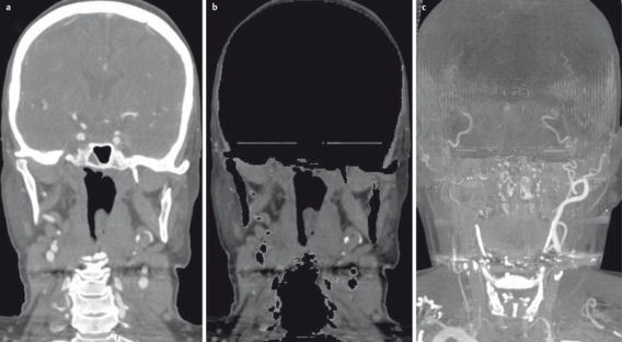 Figure 22