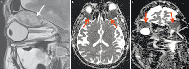 Figure 32