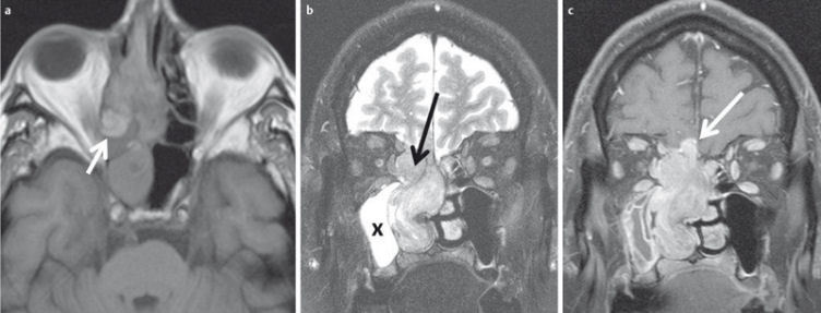 Figure 29