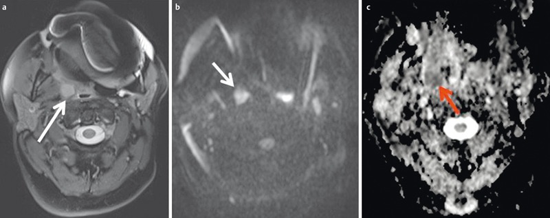 Figure 27