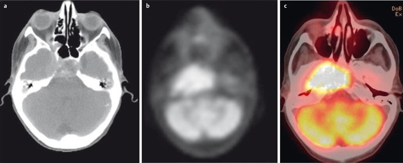 Figure 23