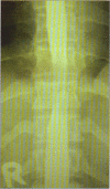 Figure 1a