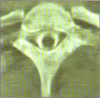 Figure 2d