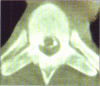 Figure 2b