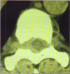 Figure 1c