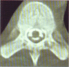 Figure 2c
