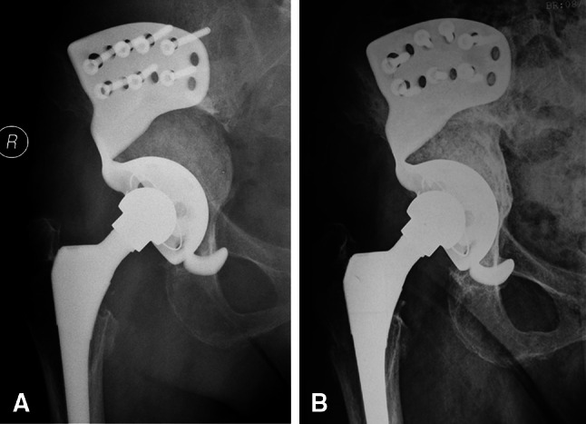 Fig. 4A–B