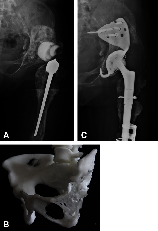 Fig. 3A–C