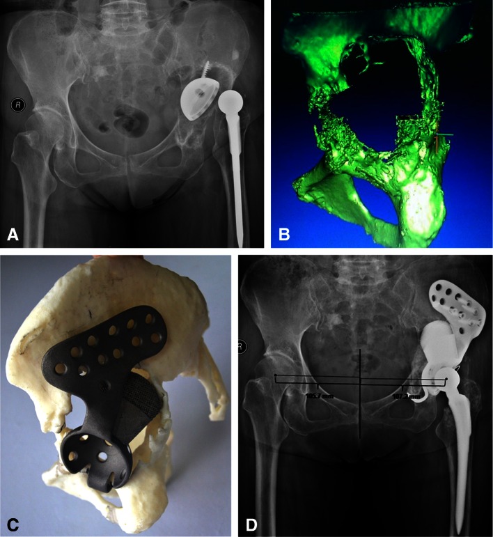 Fig. 2A–D