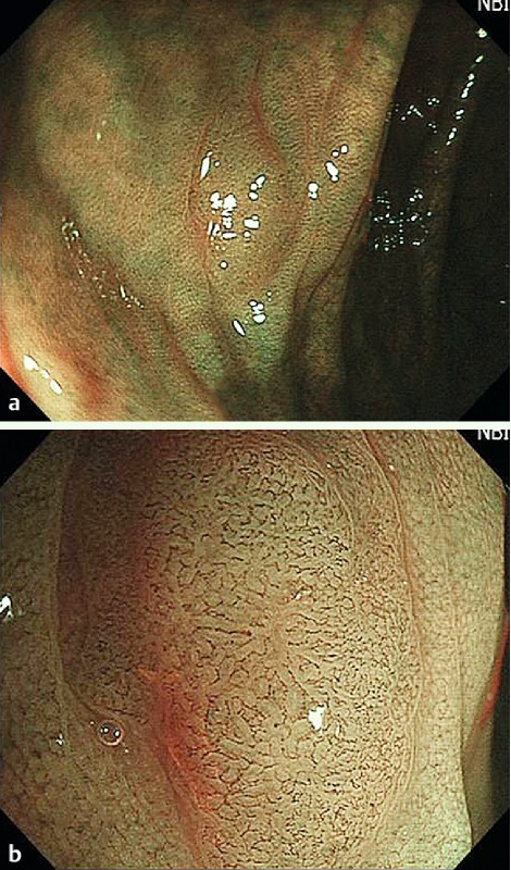 Fig. 1