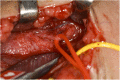 Fig. 2-B