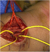 Fig. 2-A