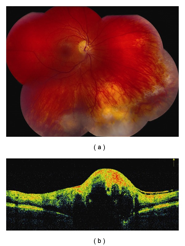 Figure 13