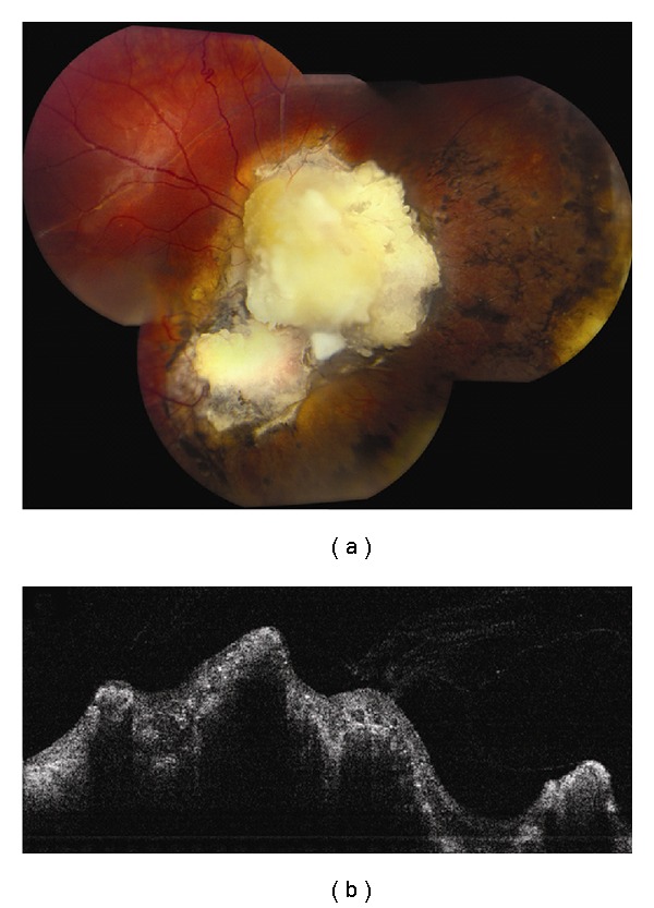 Figure 9