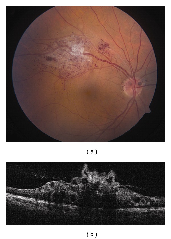 Figure 11