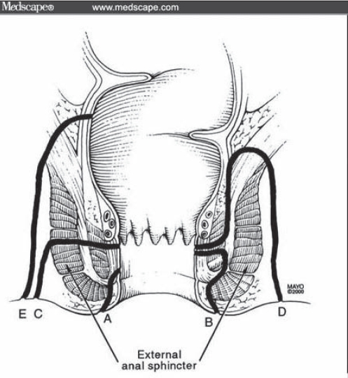 Figure 3)