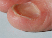 Fig 4.