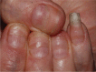 Fig 6.