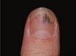 Fig 2.