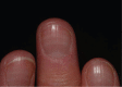 Fig 3.
