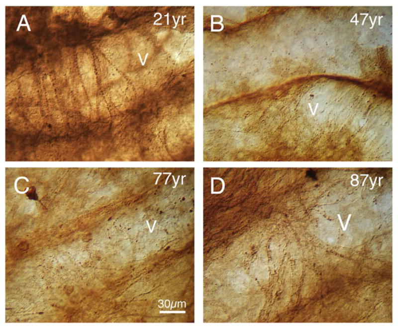 Fig. 20